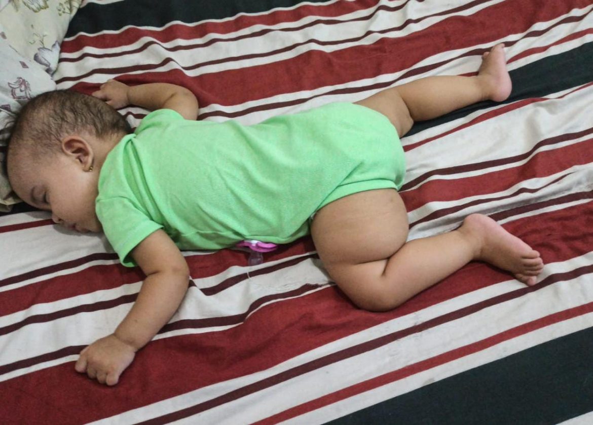 30 cidades família do bairro são luís inicia campanha para tratamento de criança com linfangioma na perna –divulgaÇÃo